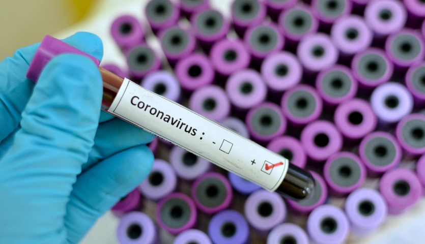 Tres casos de Covid-19 hasta el momento fueron detectados en el Ministerio de Salud. Foto: Farmaindustria