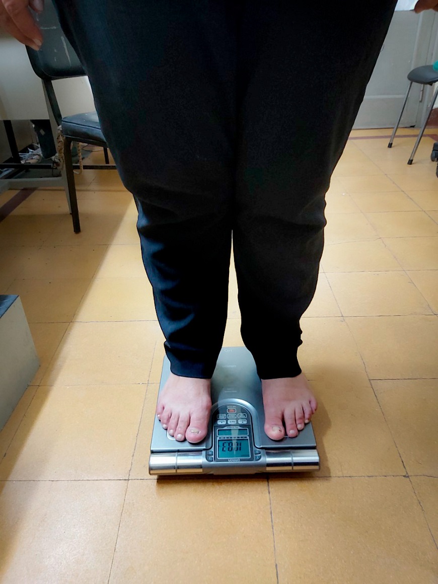 Paraguay atraviesa preocupante epidemia de obesidad, dice médica