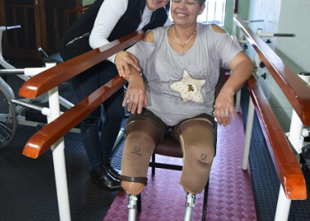 15 personas son beneficiadas con prótesis a través de programa impulsado por Itaipu