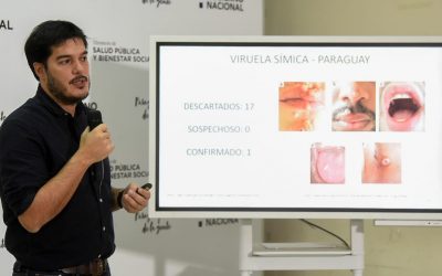 Primer paciente con viruela del mono en Paraguay vino de Brasil y se encuentra estable, según Salud