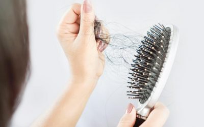 Caída de cabello, otro efecto post chikungunya
