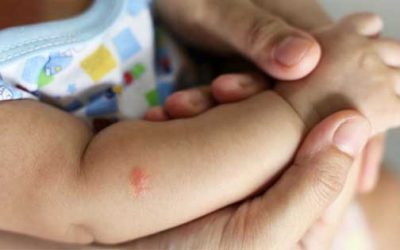 Chikungunya: instan a proteger a los bebés con repelentes desde los dos meses